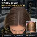 Women Scalp Micropigmentation London | Natural Hair Loss Solution