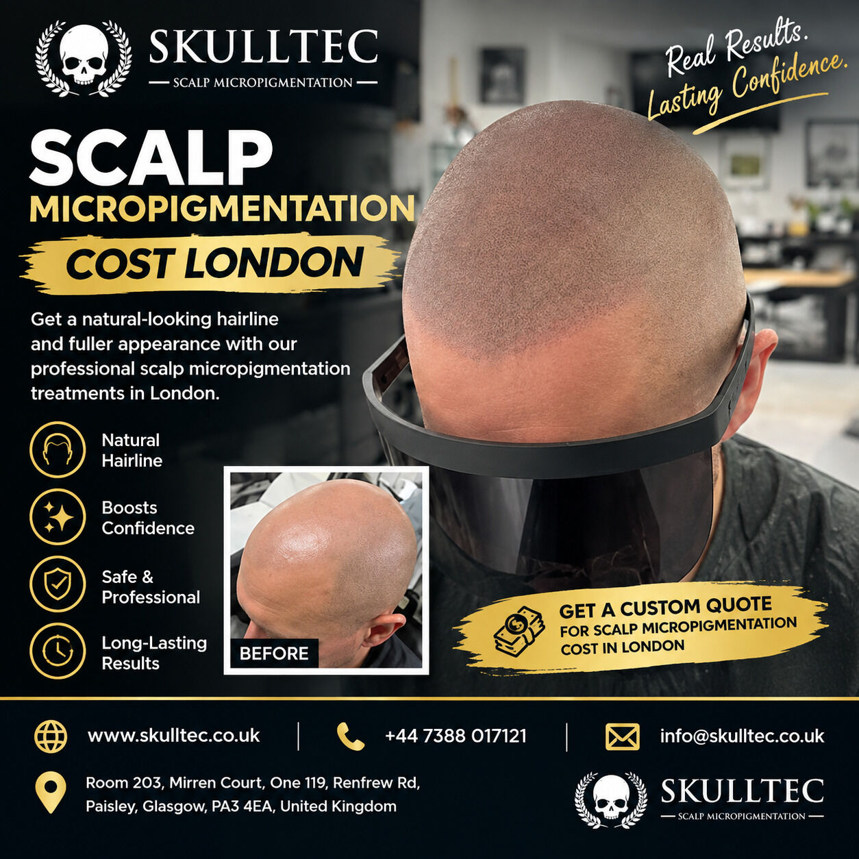 London, Health, Scalp Micropigmentation Cost London | SMP For Hair