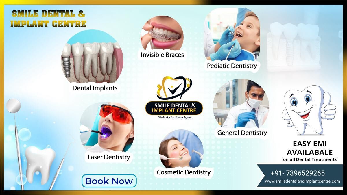 Hyderabad, Dental, Top Dental Clinic In AS Rao Nagar, Sainikpuri | Smile Dental And Implant Centre