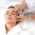 Microneedling Tampa For Smoother And Healthier Looking Skin