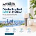 Dental Implant Cost Portland &ndash; Know Your Options