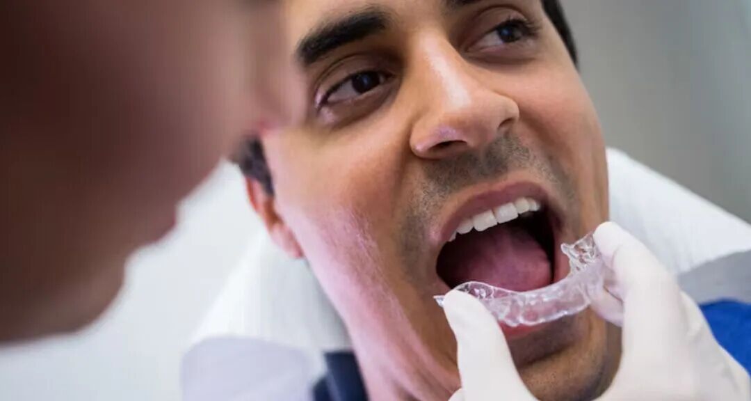 Sydney, Dental, Ultimate Guide To Custom Nightguards From Cosmetic Dentist In Ormeau