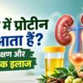 Urine Mein Protein Kyun Aata Hai? Karan, Lakshan Aur Ayurvedic Ilaj