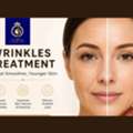 Advanced Treatment For Deep Facial Wrinkles In Thane | DNA Royal.
