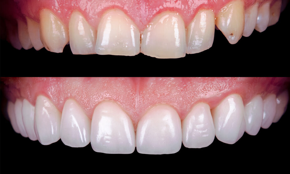 New Delhi, Dental, Dental Clinic Near Pusa Road Metro