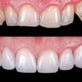 Dental Clinic Near Pusa Road Metro
