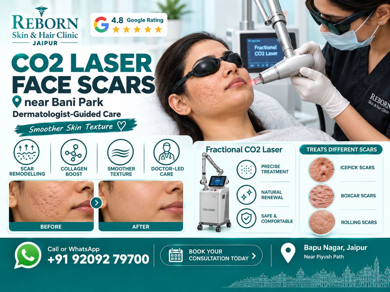 Jaipur, Health & Beauty Items, INR 4000,  CO2 Laser Treatment For Face Scars Near Bani Park Jaipur