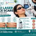 INR 4000,  CO2 Laser Treatment For Face Scars Near Bani Park Jaipur
