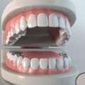 Root Canal Treatment In NIBM, Pune | The Dental Ethics
