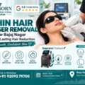 INR 2000,  Chin Hair Laser Removal Near Bajaj Nagar Jaipur For Long-Lasting Hair Reduction