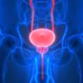 Hope & Healing Through Prostate Cancer Treatment In Noida