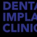 Dental Implant Clinic Dublin