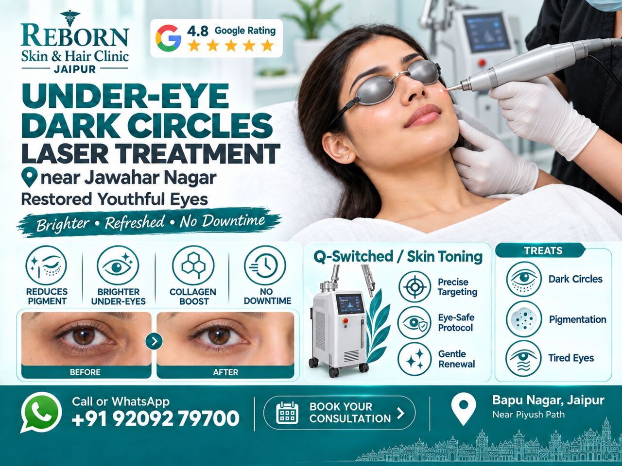 Jaipur, Health & Beauty Items, INR 3000,  Laser Treatment For Under-Eye Dark Circles Near Jawahar Nagar, Jaipur