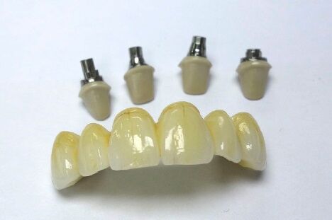 Beijing, Dental, Order Quality Crown And Bridge Works From China At Competitive Prices