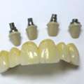 Order Quality Crown And Bridge Works From China At Competitive Prices