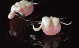 Beijing, Dental, Lightweight Partial Dentures China &ndash; Comfort, Precision & Quality