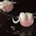 Lightweight Partial Dentures China &ndash; Comfort, Precision & Quality