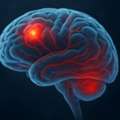Consult Best Brain Cancer Doctor In Noida &ndash; Dr. Manish Singhal