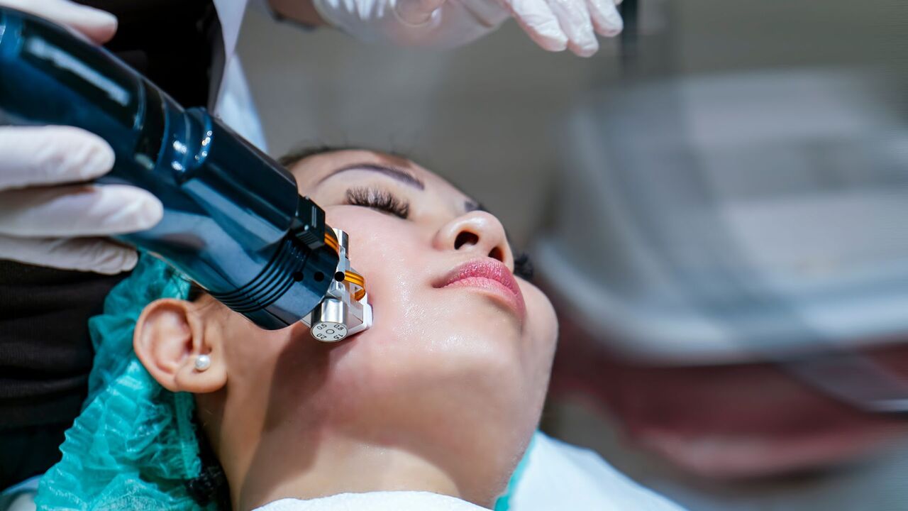 Dubai, Beautician, Radiofrequency Microneedling In Dubai: Advanced Skin Rejuvenation