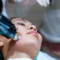 Radiofrequency Microneedling In Dubai: Advanced Skin Rejuvenation
