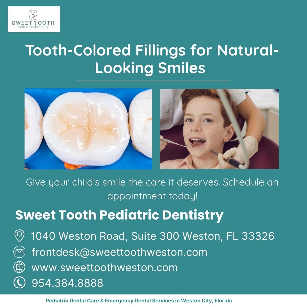 New York, Dental, Tooth-Colored Fillings For Natural-Looking Smiles
