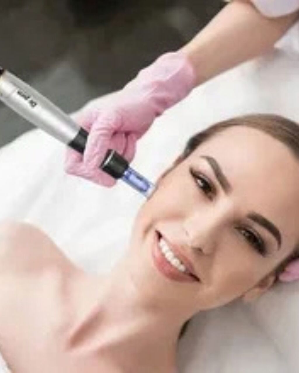 Hawalli, Business, RF Microneedling Treatment