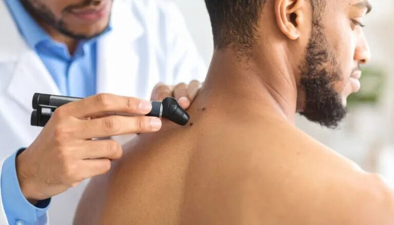 New York, Health, Expert Skin Cancer Surgery And Treatment Services In California