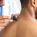 Expert Skin Cancer Surgery And Treatment Services In California
