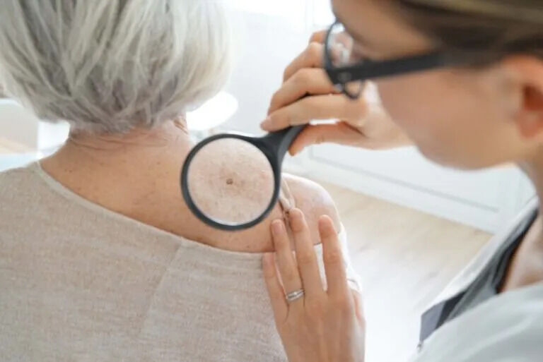New York, Health, Expert Skin Cancer Surgery And Treatment Services In California