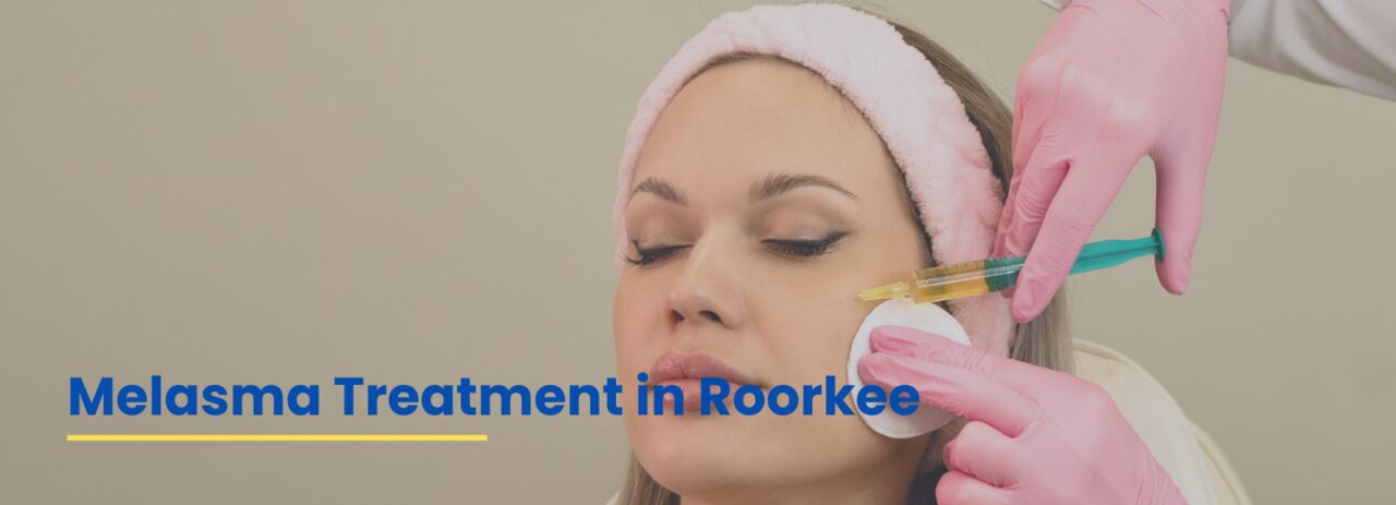 Mumbai, Health, Melasma Treatment In Roorkee