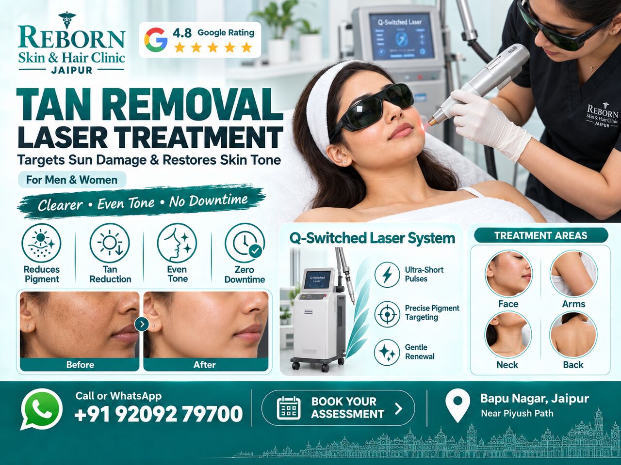 Jaipur, Health & Beauty Items, INR 2500,  Tan Removal Laser Treatment In Jaipur For Sun-Damaged And Uneven Skin
