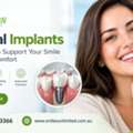 Dental Implants For A Natural-Looking Smile And Confident Everyday Life