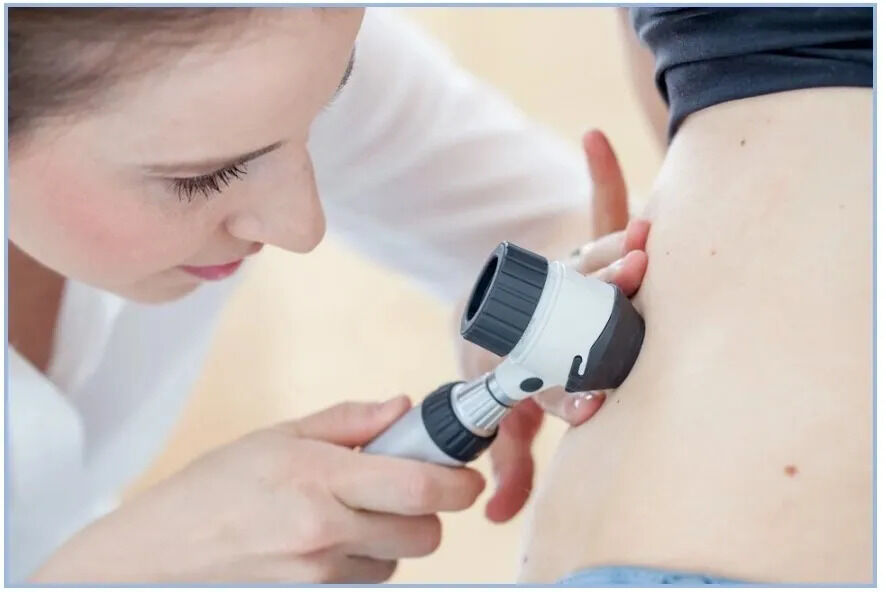 New York, Health, Professional Melanoma Diagnosis And Treatment Services