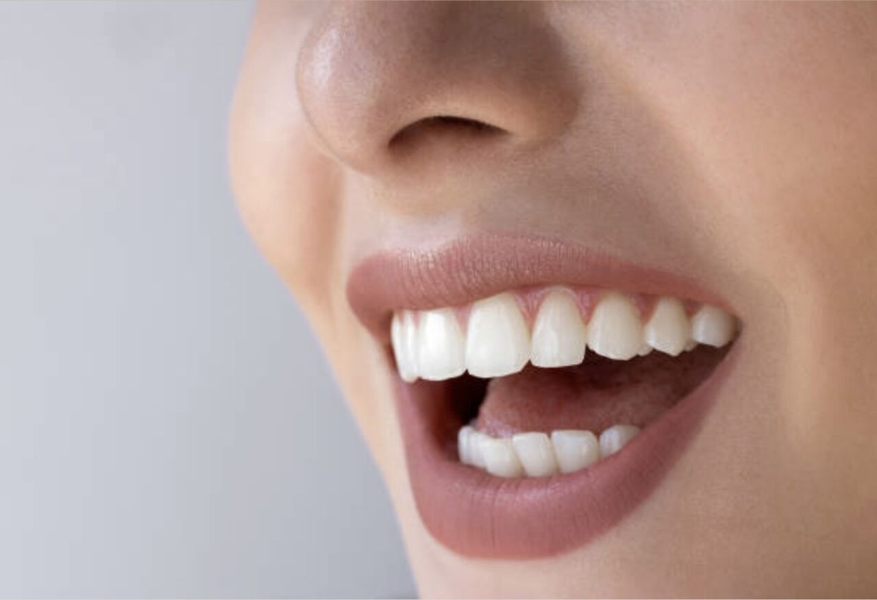 Auckland, Health, Tooth Color Fillings In Mount Roskill