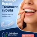 Best Invisalign Braces Treatment In Delhi