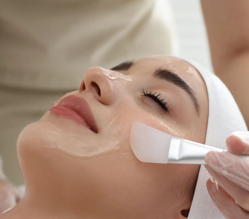 Dallas, Health, Professional Chemical Face Peels Treatment In Dallas - MyFitMed