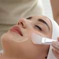 Professional Chemical Face Peels Treatment In Dallas - MyFitMed