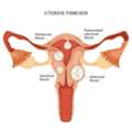 Detailed Uterine Evaluation In Delhi By Fertility Experts