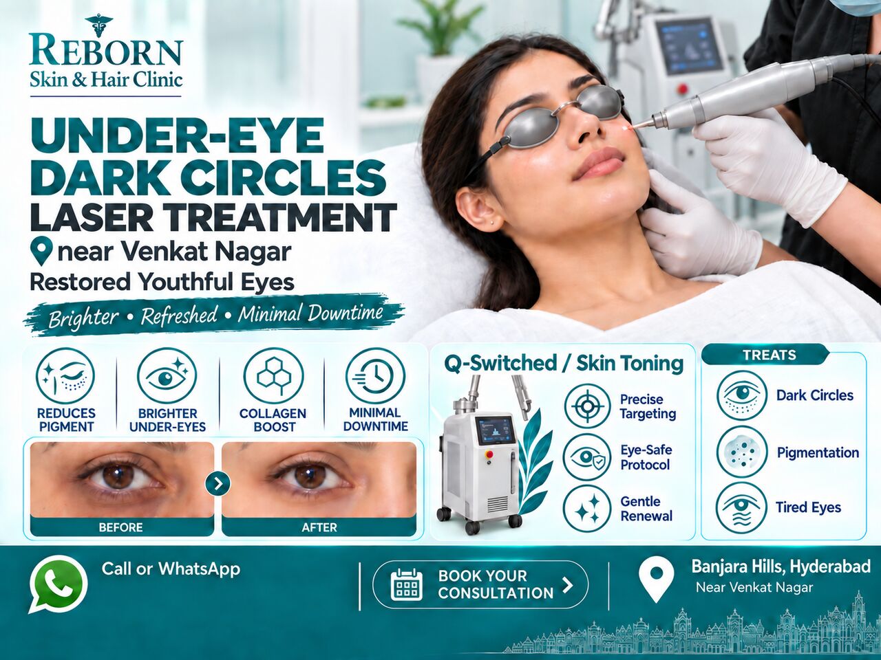 Hyderabad, Health & Beauty Items, INR 3000,  Under-Eye Dark Circles Laser Treatment Near Venkat Nagar | Book Your Assessment