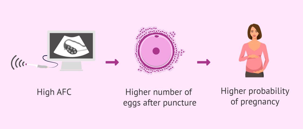 New Delhi, Health, Accurate Ovarian Reserve Testing In Delhi | Fertylity IVF