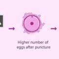 Accurate Ovarian Reserve Testing In Delhi | Fertylity IVF