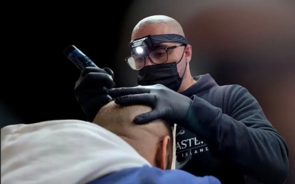 New York, Beautician, Scalpmasters - Scalp Micropigmentation Hair Clinic