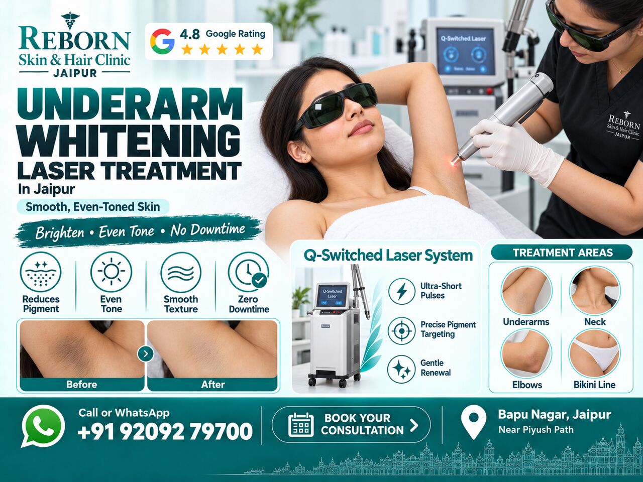 Jaipur, Health & Beauty Items, INR 3000,  Underarm Whitening Laser Treatment In Jaipur For Dark Underarms
