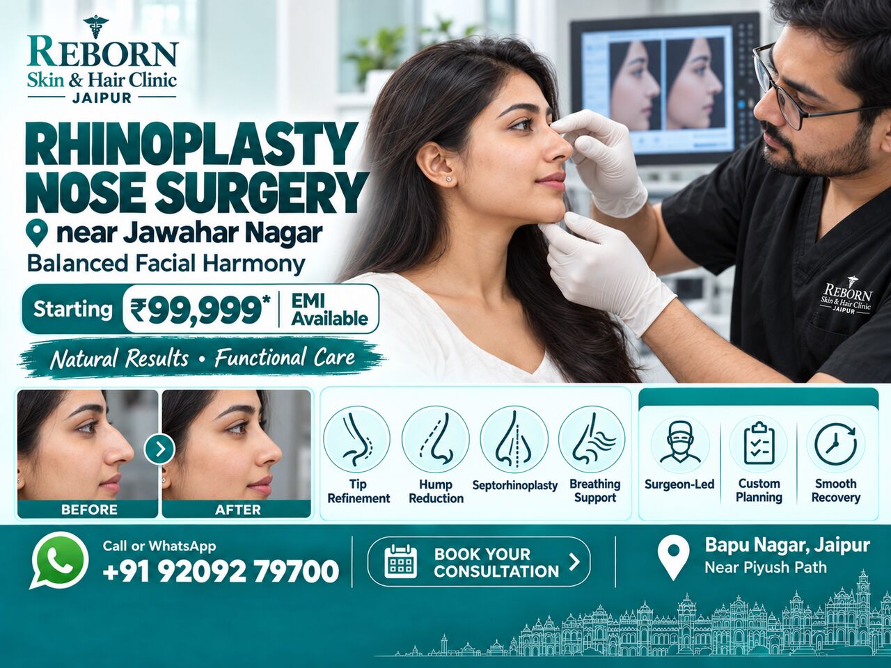 Jaipur, Health & Beauty Items, INR 99999,  Rhinoplasty Nose Surgery Near Jawahar Nagar, Jaipur For Natural Facial Balance