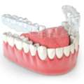 Invisalign Treatment In NIBM Pune | Clear Aligners
