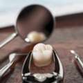 Checkout The Wisdom Teeth Removal Services Of Dental Clinic Near Me Ormeau City
