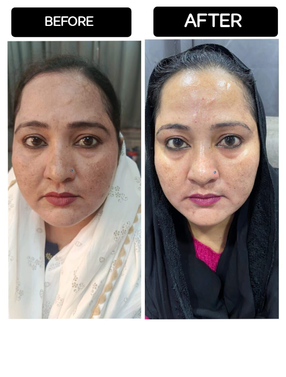 New Delhi, Health, Skin Specialist In Delhi