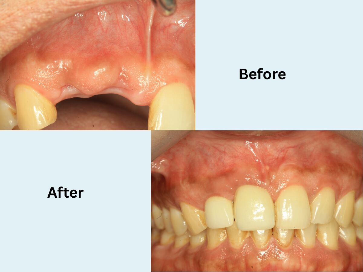 Pune, Health, Sparkle The Dental Clinic