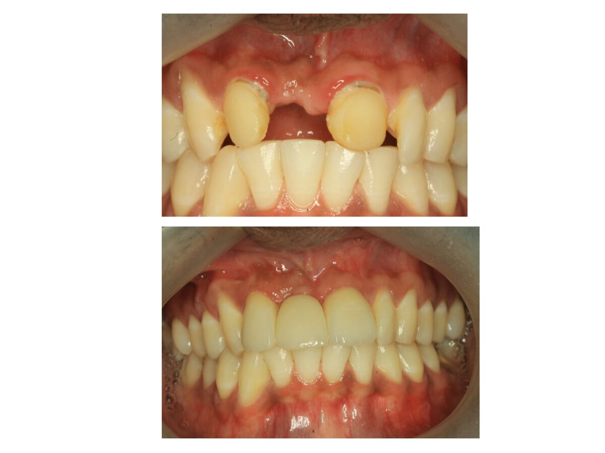 Pune, Health, Sparkle The Dental Clinic