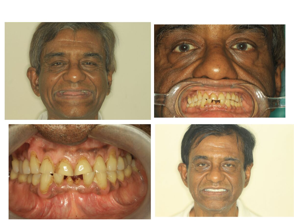 Pune, Health, Sparkle The Dental Clinic